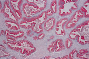 Fast Red substrate/chromogen 2-component system - Image 2
